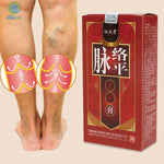 KONGDY Varicose Veins Treatment Cream Varicosity Angiitis Remedy Ointment Relief Veins Pain Phlebitis legs Varicose Veins Cream